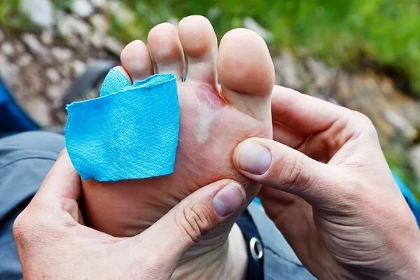 7+ Mẹo Vàng Giúp Giày Bata Da Luôn Bền Đẹp, Không Bị Bong Tróc