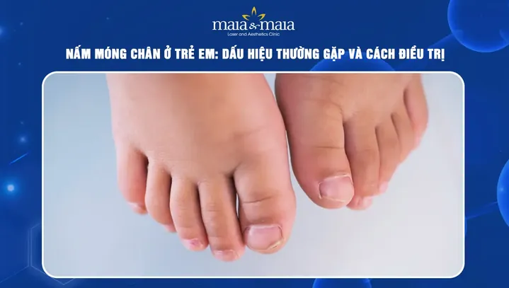 Cách Vệ Sinh Giày Bị Nấm Chân & Khử Mùi Hiệu Quả Tại Nhà