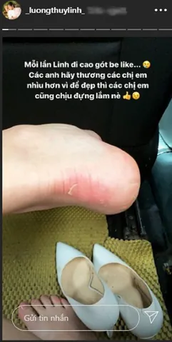 Chân Bị Xước Do Đi Giày Cao Gót: Nguyên Nhân, Cách Khắc Phục & Phòng Tránh Hiệu Quả