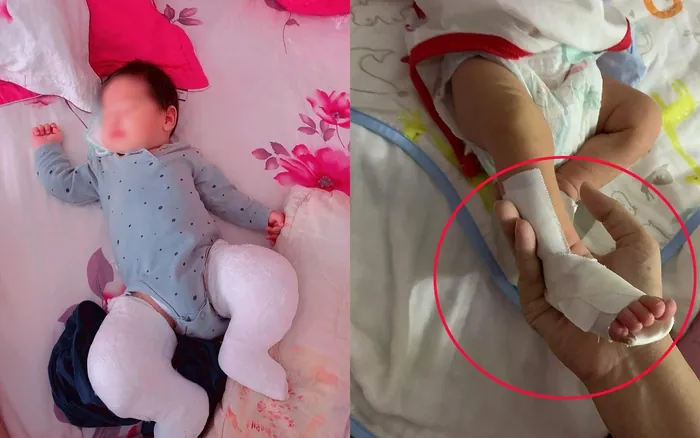 Hướng Dẫn Chi Tiết Cách Mang Giày Nẹp Cho Bé Chân Khoèo Đúng Cách Và Hiệu Quả Hướng Dẫn Chi Tiết Cách Mang Giày Nẹp Cho Bé Chân Khoèo Đúng Cách Và Hiệu Quả