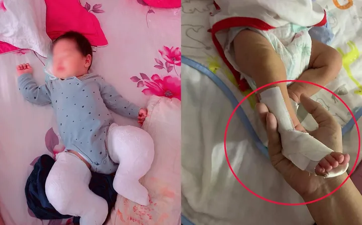 Hướng Dẫn Chi Tiết Cách Mang Giày Nẹp Cho Bé Chân Khoèo Đúng Cách Và Hiệu Quả Hướng Dẫn Chi Tiết Cách Mang Giày Nẹp Cho Bé Chân Khoèo Đúng Cách Và Hiệu Quả
