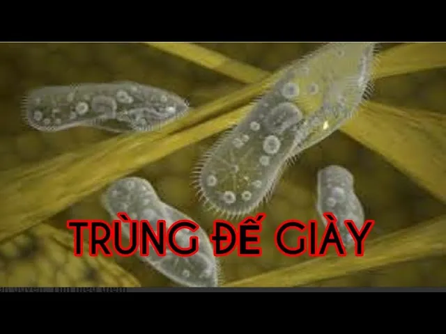 Quan Sát Trùng Giày Dưới Kính Hiển Vi: Hướng Dẫn Chi Tiết Và Kiến Thức Liên Quan
